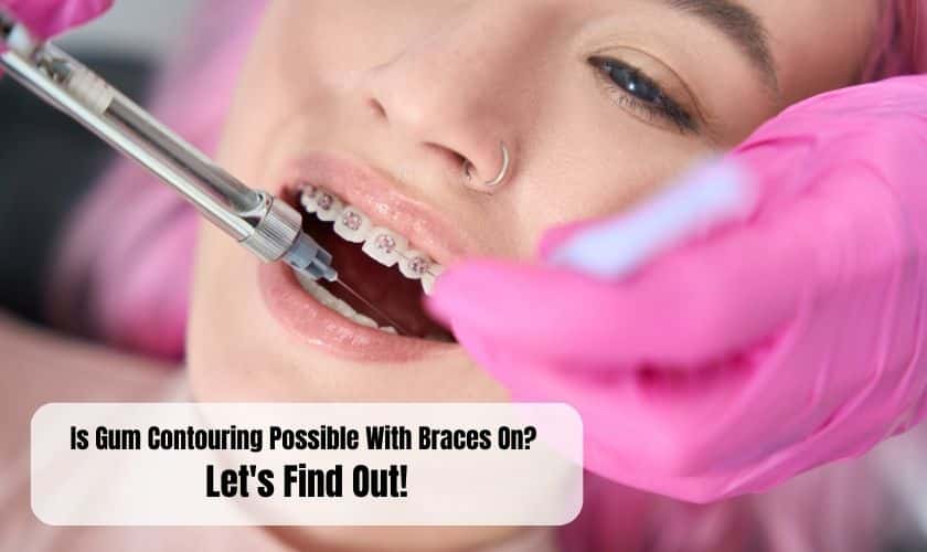 Is Gum Contouring Possible With Braces On? Let's Find Out!